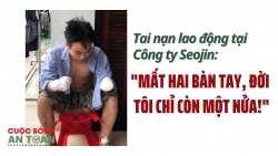 Tai nạn lao động tại Công ty Seojin: "Mất hai bàn tay, đời tôi chỉ còn một nửa!"