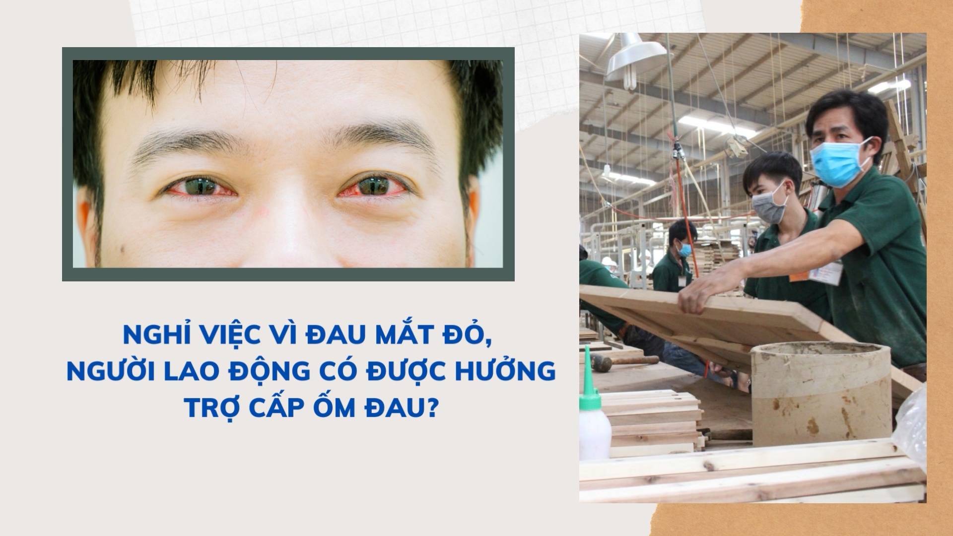 Nghỉ việc vì đau mắt đỏ, người lao động có được hưởng trợ cấp ốm đau?